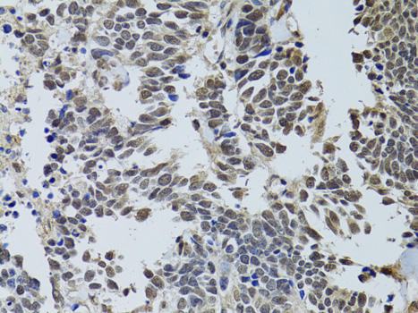 STK11 Antibody