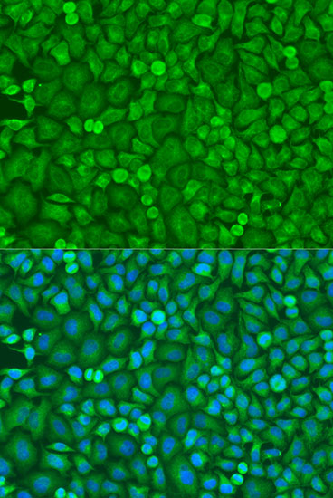 EIF4E Antibody