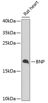 NPPB antibody