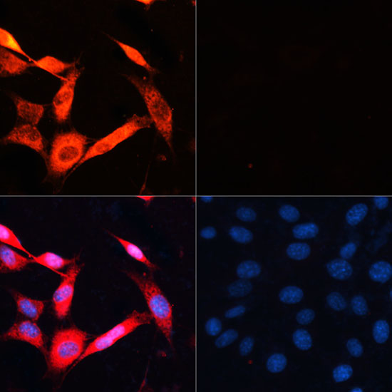 RPS6KB1 Antibody