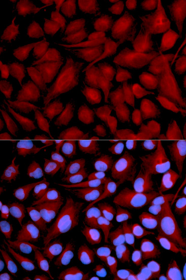 CASK Antibody