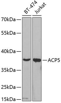 ACP5 Antibody