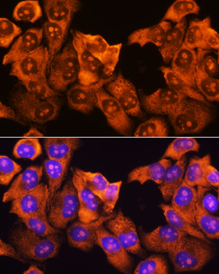 RPS3 Antibody