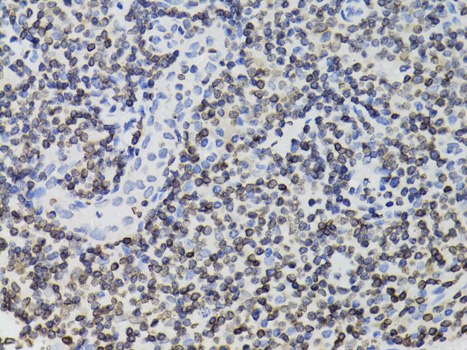 TMPO Antibody