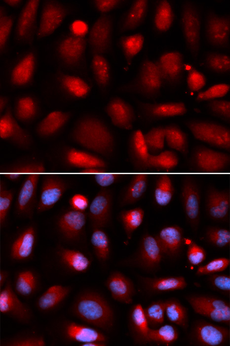 p65 Antibody