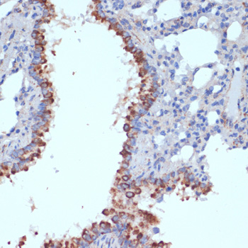 AIFM1 Antibody