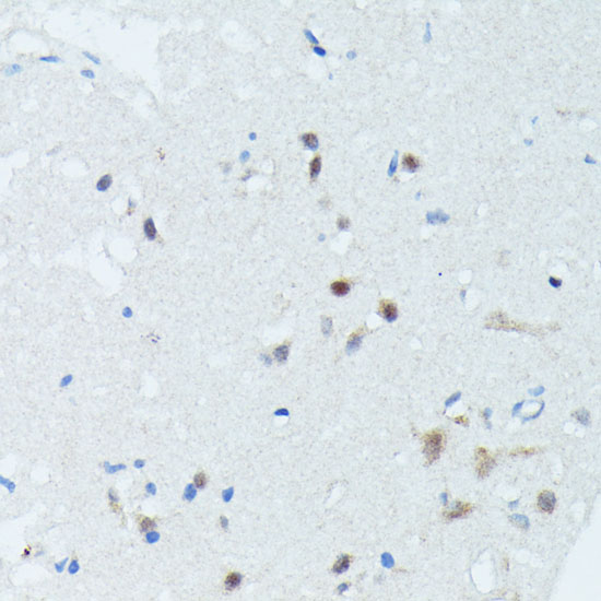 MEF2C Antibody