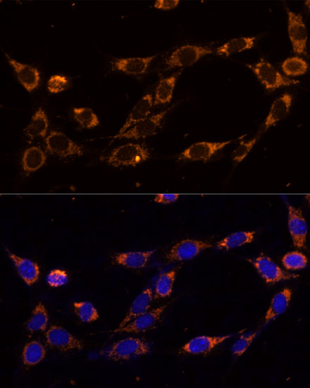 TRAP1 antibody