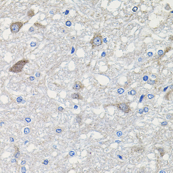 CDH23 antibody