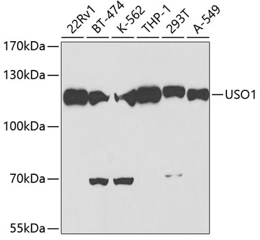 USO1 antibody