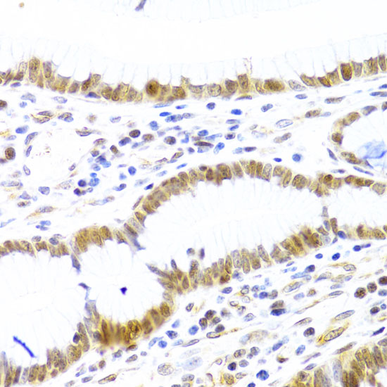 MCM4 antibody