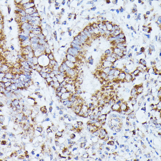 PPP2CB antibody