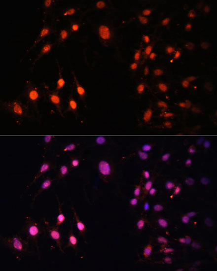 SETD2 antibody