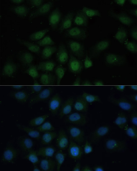 CREB1 Antibody