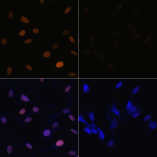 Acetyl-Histone H4-K16 pAb