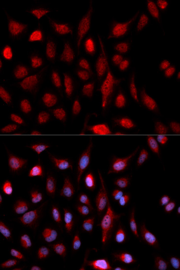 ASH2L Antibody