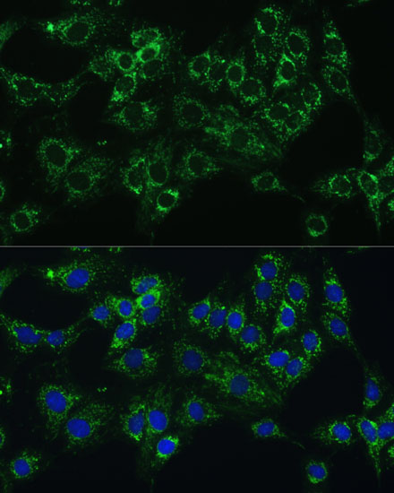 CYB5A Antibody