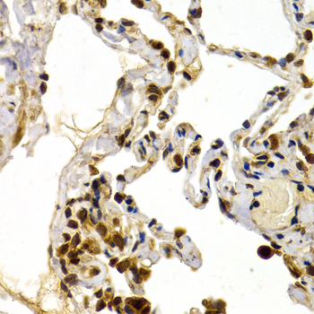 TFDP1 Antibody