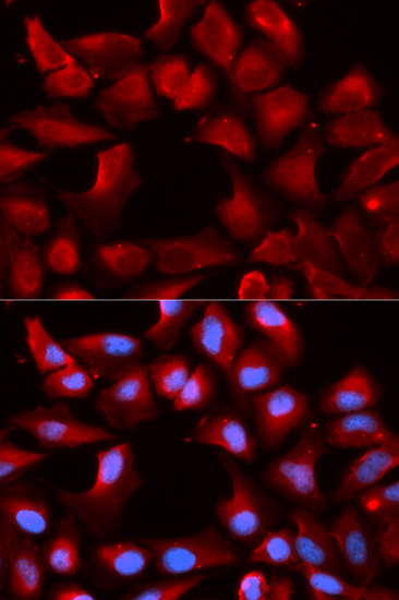 DNAJB1 Antibody