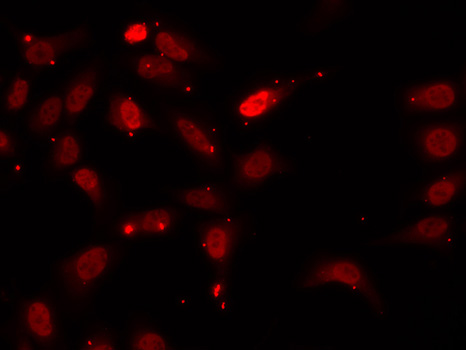 HNRNPF Antibody