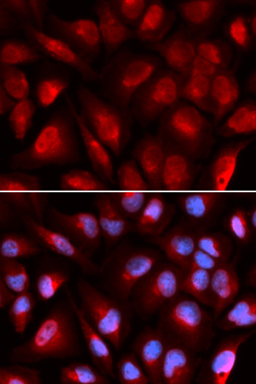 MCM5 Antibody