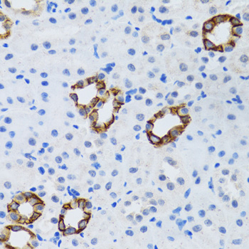 GABARAP Antibody