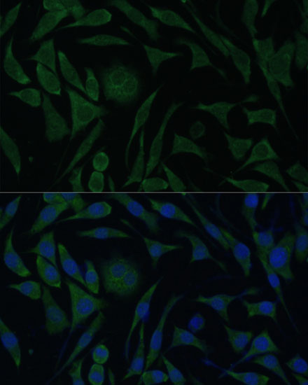 PGRMC1 Antibody