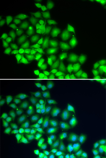 ERCC2 antibody