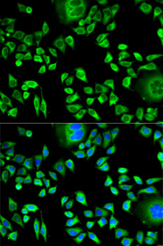 CSTA Antibody