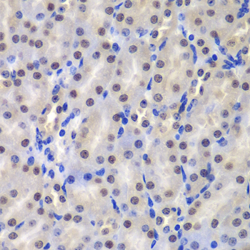 GSTP1 Antibody