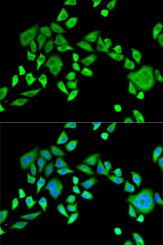 SH3GL2 Antibody