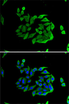 HPSE Antibody