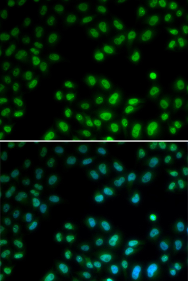 PIAS1 antibody