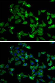 SND1 antibody