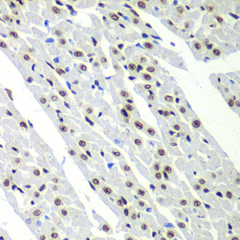 SF3B2 antibody