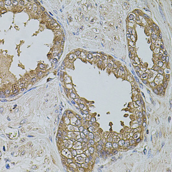 KTN1 antibody