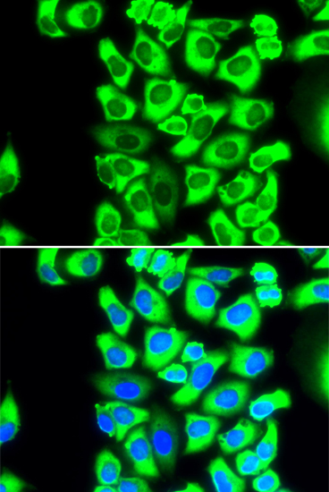 RPS3A antibody