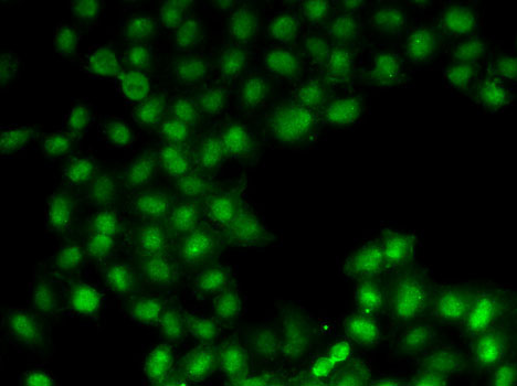 C11orf30 antibody