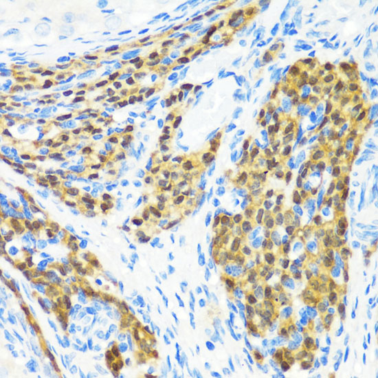 MLL5 antibody