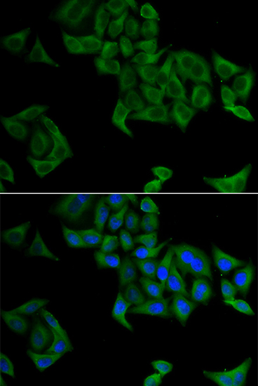 SMYD5 antibody