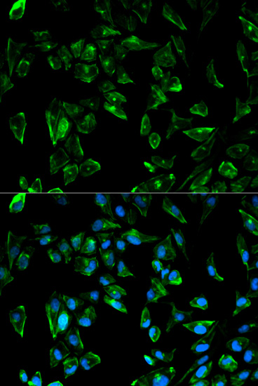 TPM3 Antibody