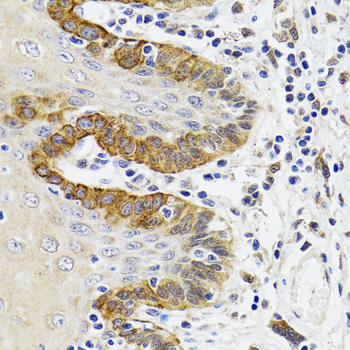 ESD antibody