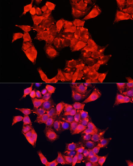 AOC1 antibody