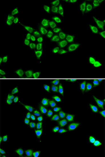 PC antibody