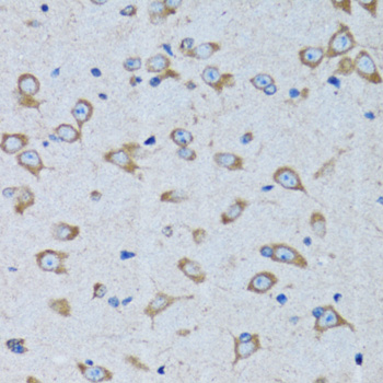 RARS antibody