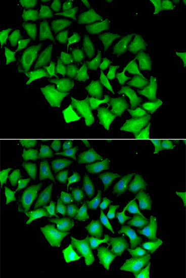 ACY1 antibody