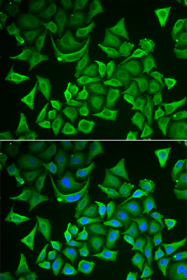 DTYMK antibody