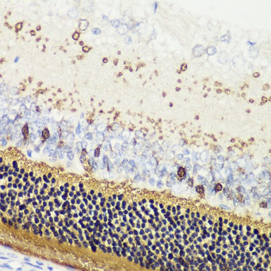 RCVRN antibody