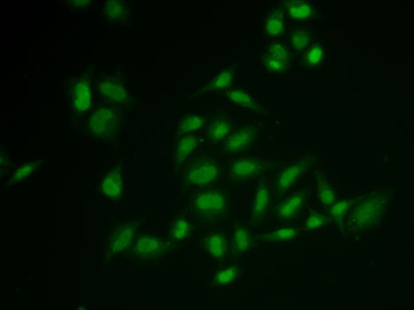 SSRP1 antibody