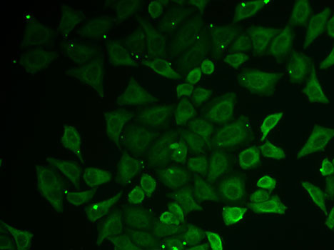 C21orf33 antibody